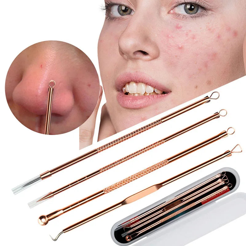 Povei Blackhead Remover Tool Set - Facial Pore Cleaner and Acne Extractor Kit