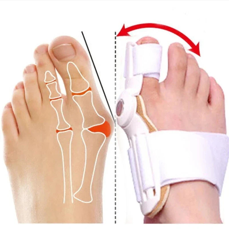 Povei Big Bone Toe Bunion Corrector Straightener Separator Protector Hallux Valgus