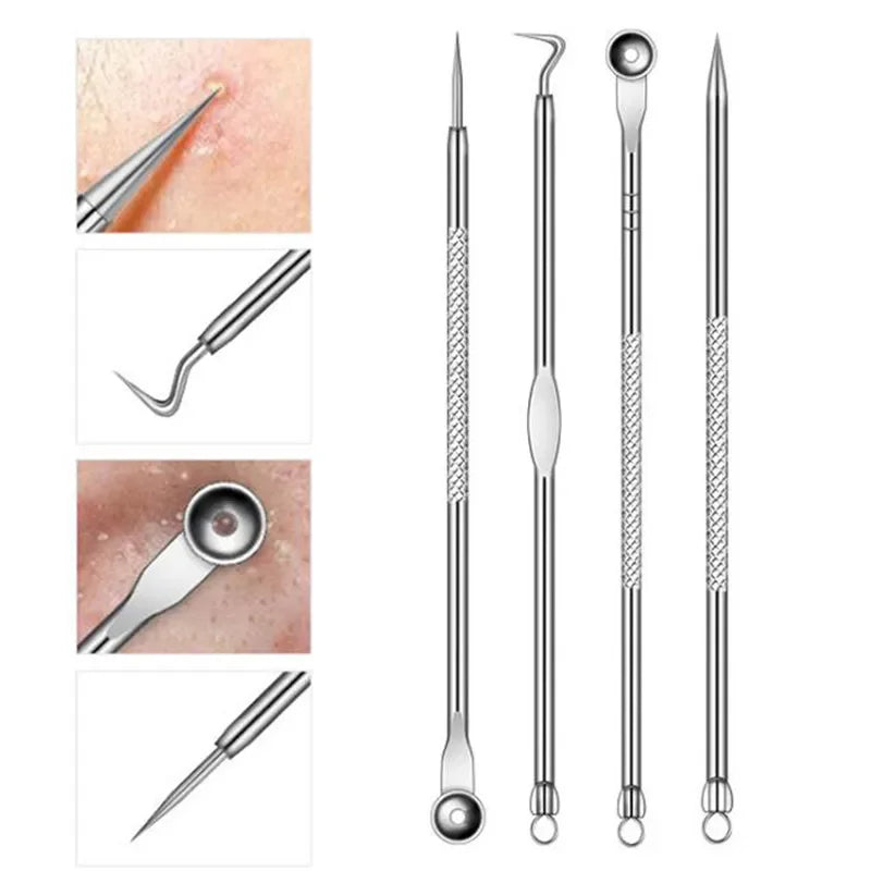 Povei Acne Blackhead Removal Tools Set - Stainless Steel Comedone Extractor Kit