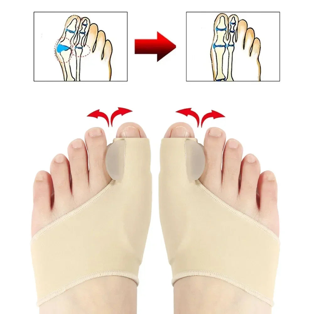 Povei Bunion Corrector & Toe Separator for Hallux Valgus Correction