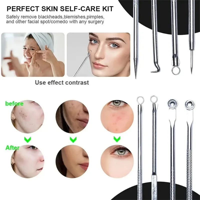 Povei Acne Blackhead Removal Needles Set for Deep Cleansing and Pore Care