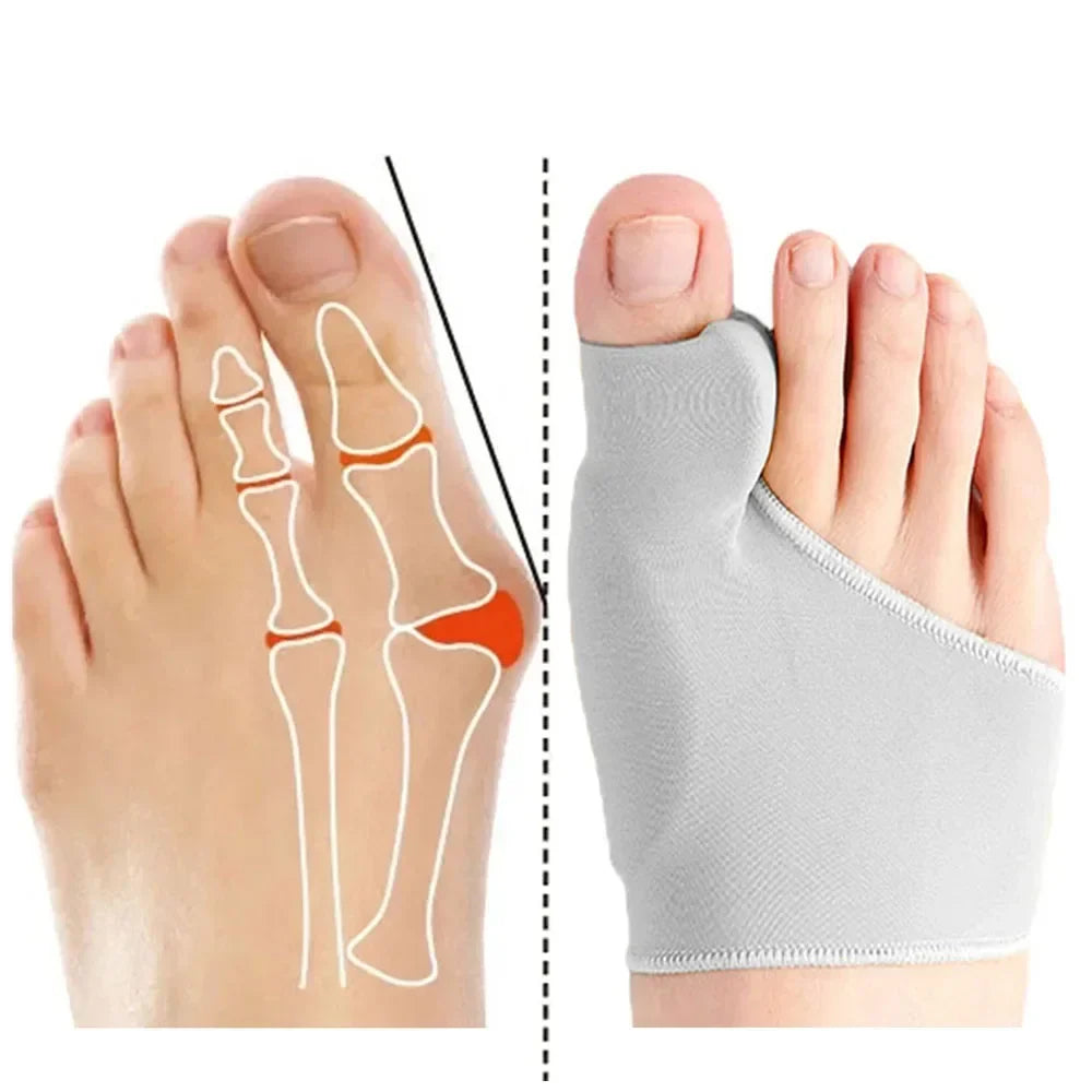 Povei Bunion Corrector & Toe Separator for Hallux Valgus Correction