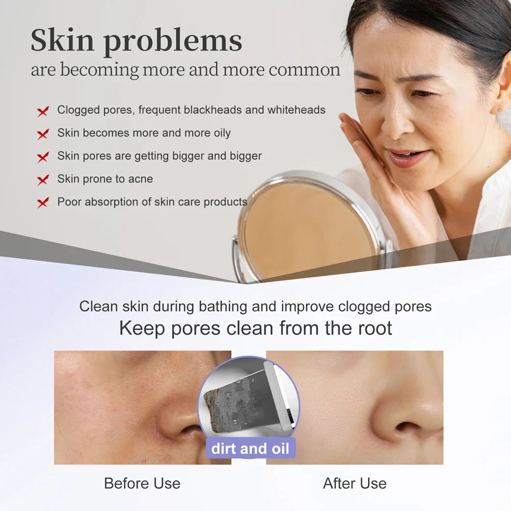 Povei Ultrasonic Skin Scrubber & EMS Face Lifting Machine with LED Therapy