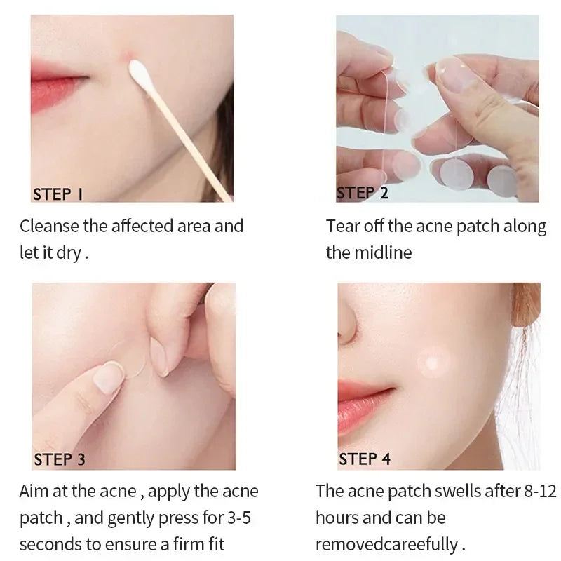 Povei Acne Patches: Invisible Hydrocolloid Stickers for Pimple Removal & Repair