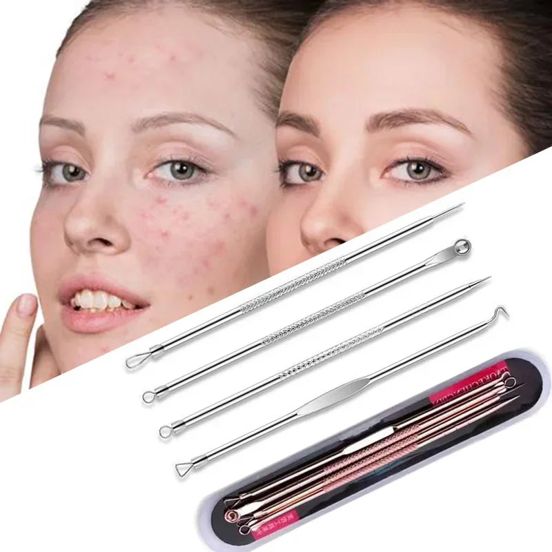 Povei Acne Blackhead Removal Needles Set - Deep Cleansing Tool for Clear Skin