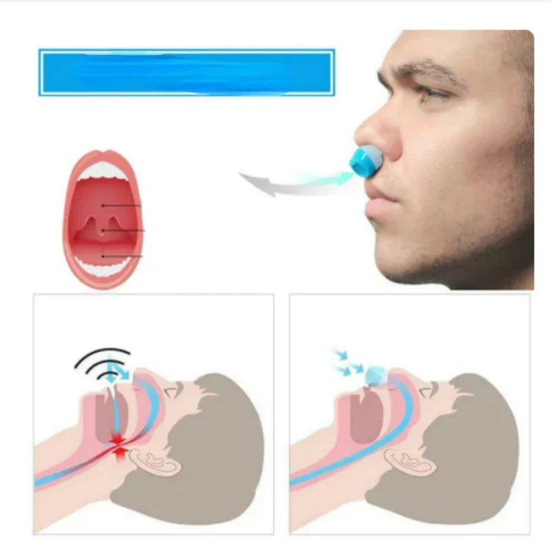 Povei Anti Snore Nose Clip Sleep Tray Sleeping Aid Device