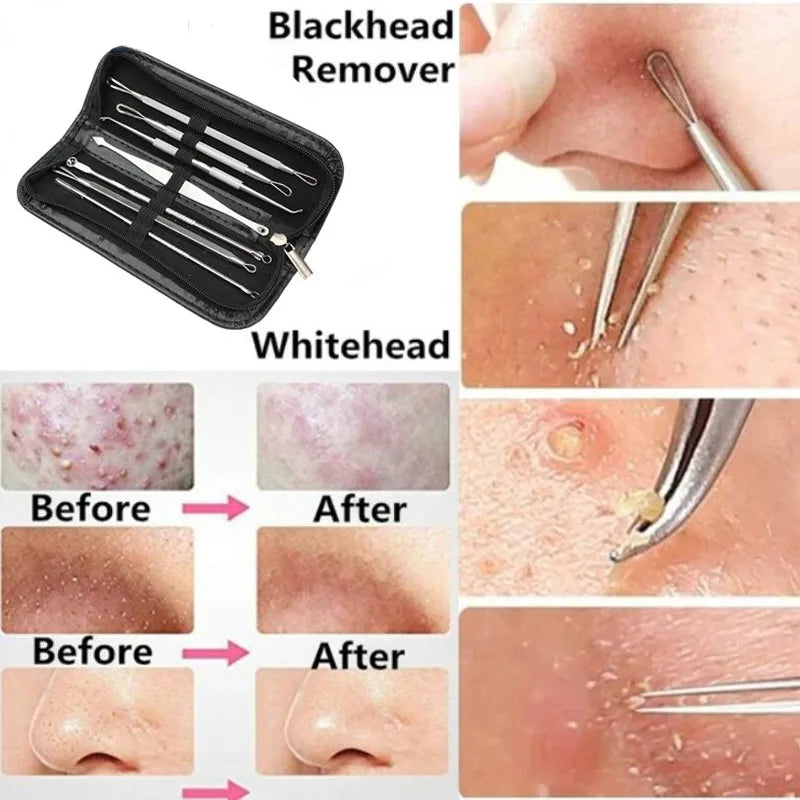 Povei Blackhead Remover Kit with Face Massager