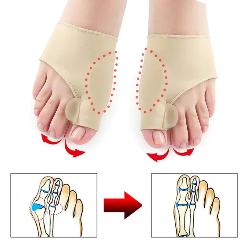 Bunion Corrector Gel Pad Hallux Valgus Protector Toe Separator by Povei