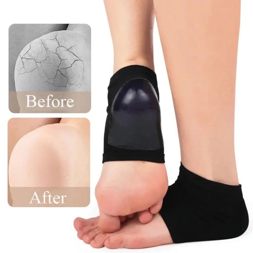 2Pcs Povei Heel Protector Silicone Socks for Plantar Fasciitis and Foot Care