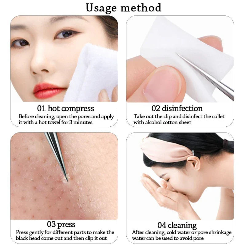 Povei Blackhead Pimples Extractor Acne Remover Tool for Face Skin Health