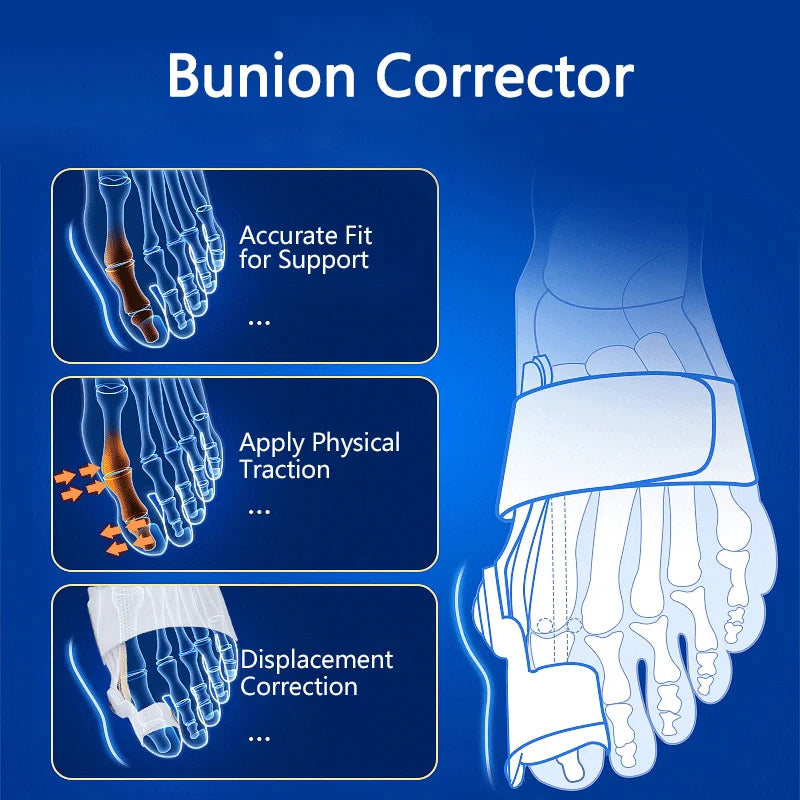 Povei Bunion Corrector Toe Separator for Hallux Valgus Correction