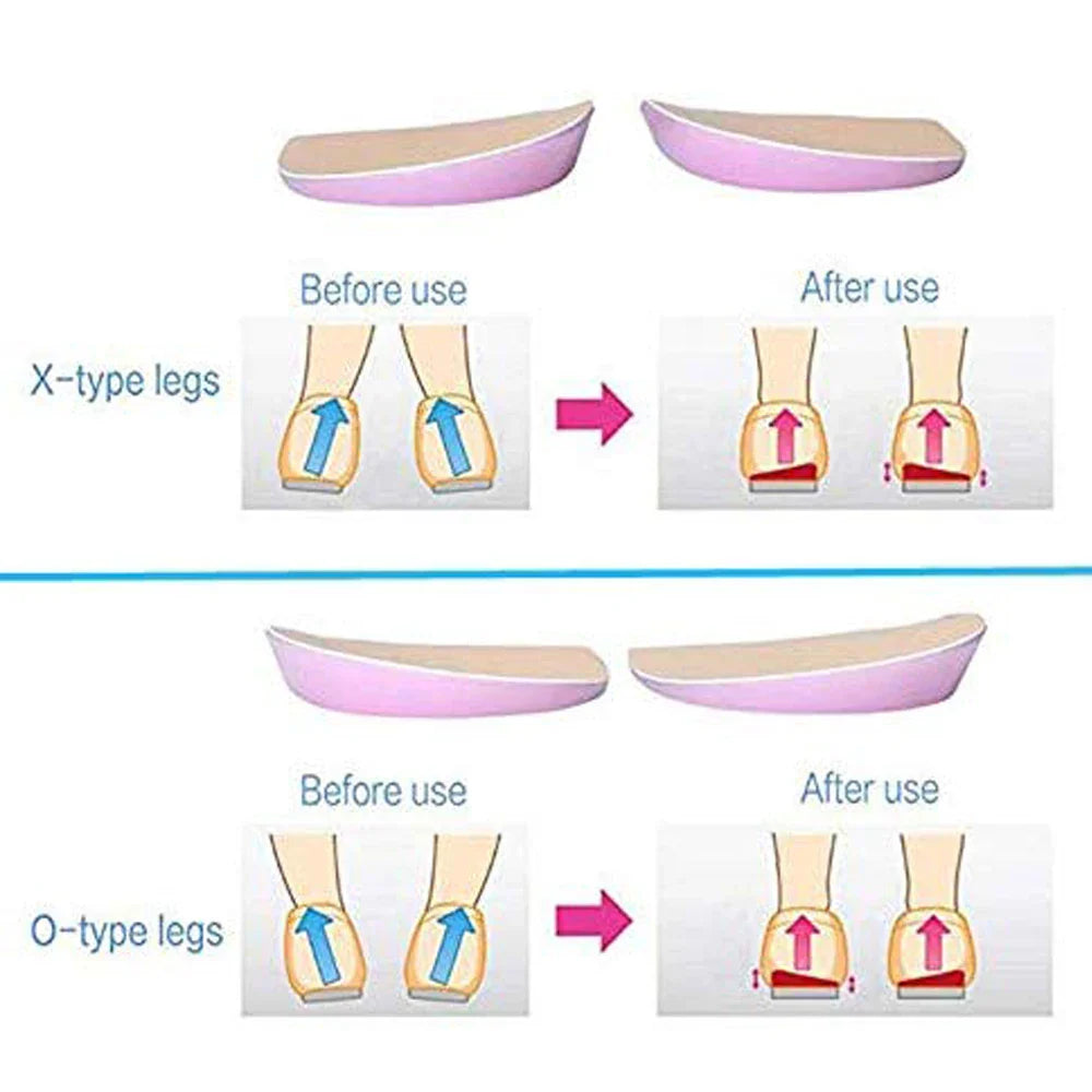 Povei Arch Support Silicone Gel Insoles for Women Flat Feet Pain Relief