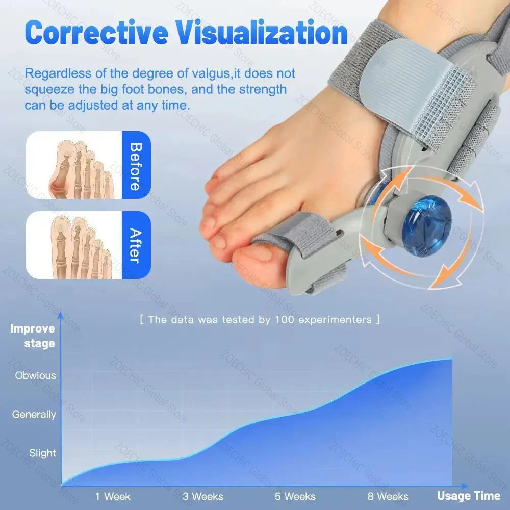 Povei Bunion Corrector & Big Toe Straightener - Adjustable Hallux Valgus Corrector