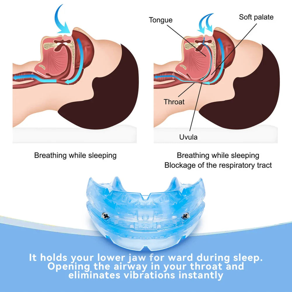 Povei Adjustable Anti Snoring Mouthpiece for Better Sleep