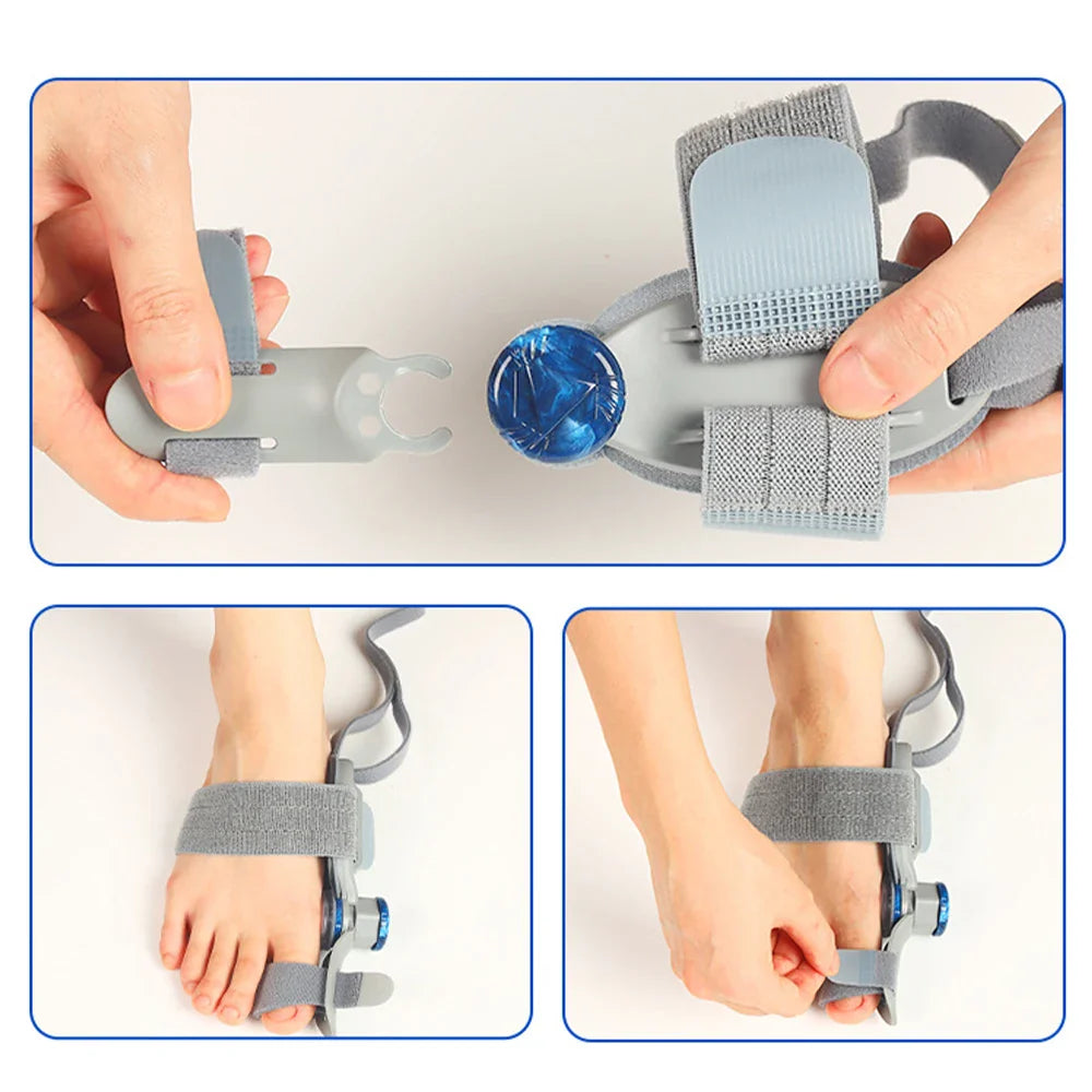 Povei Bunion Corrector & Big Toe Straightener - Adjustable Hallux Valgus Corrector