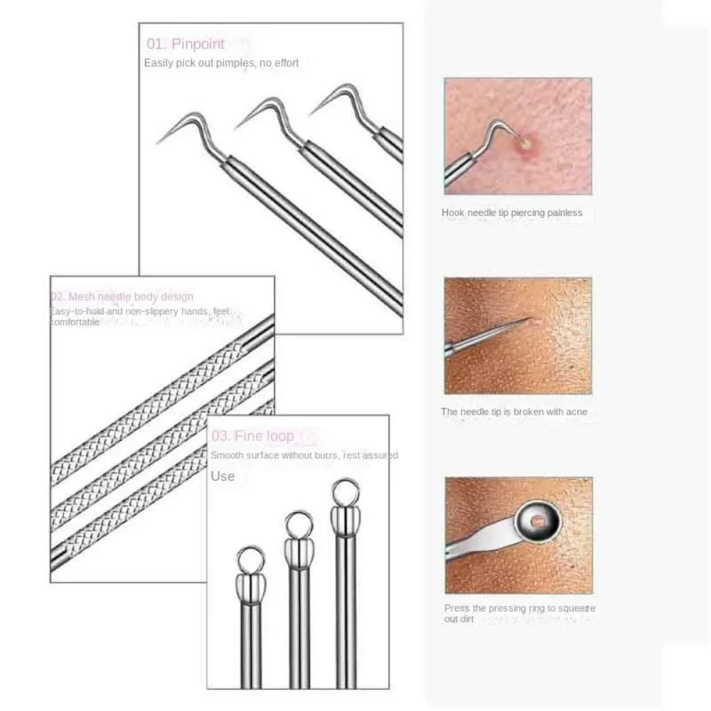 Povei Acne Blackhead Remover Set - Skin Care Blemish Extraction Tool