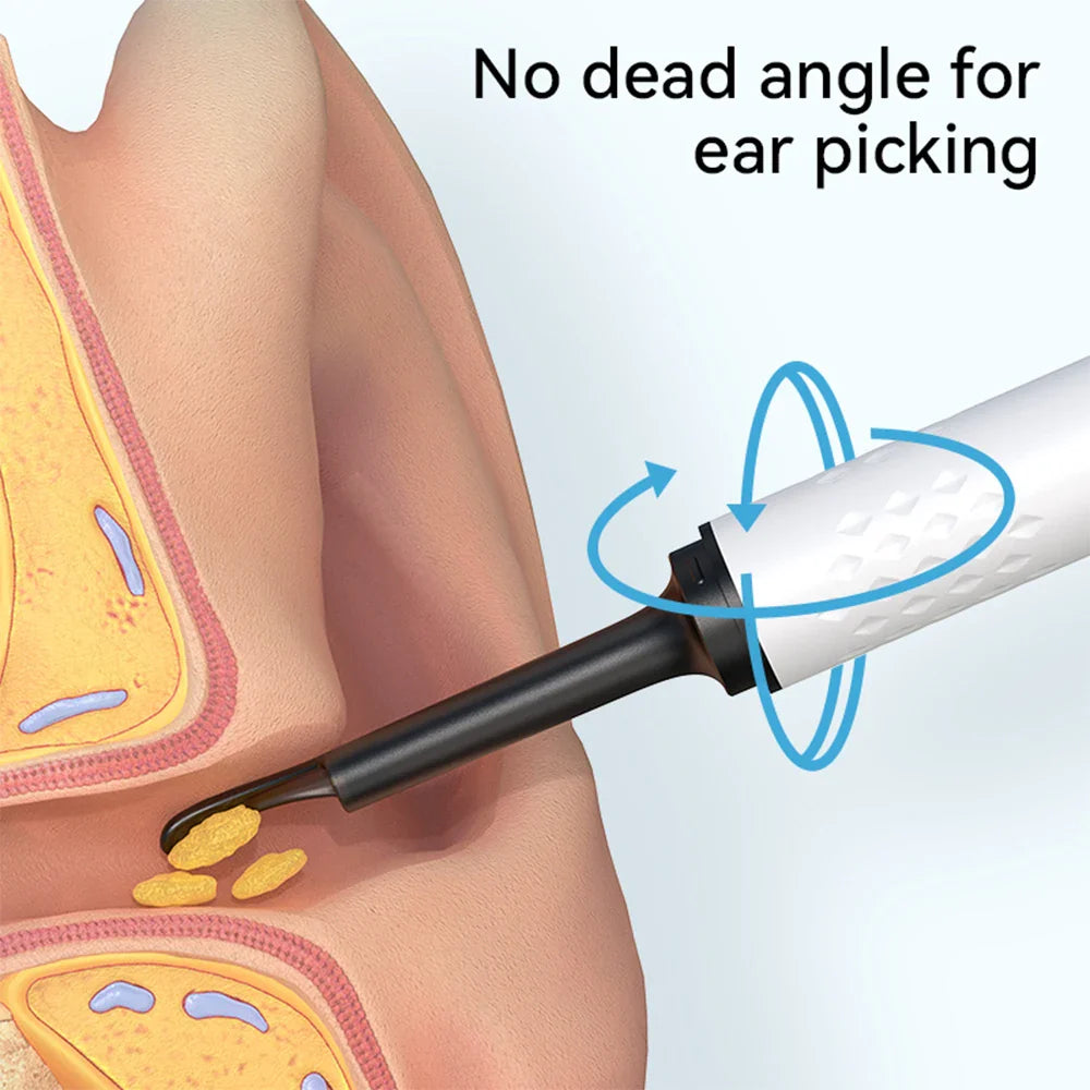 Povei Ear Care Kit: High-definition Otoscope with Luminous Endoscopy