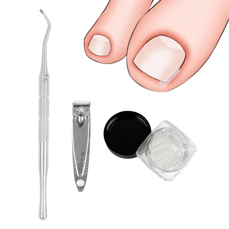 Povei Ingrown Toenail Correction Kit: Sticker, Clip, Brace Pedicure Tool