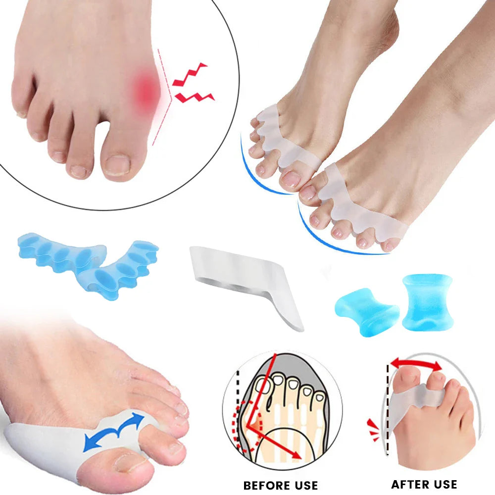 Povei Silicone Toe Separators: Bunion Corrector & Valgus Adjuster for Perfect Toe Alignment