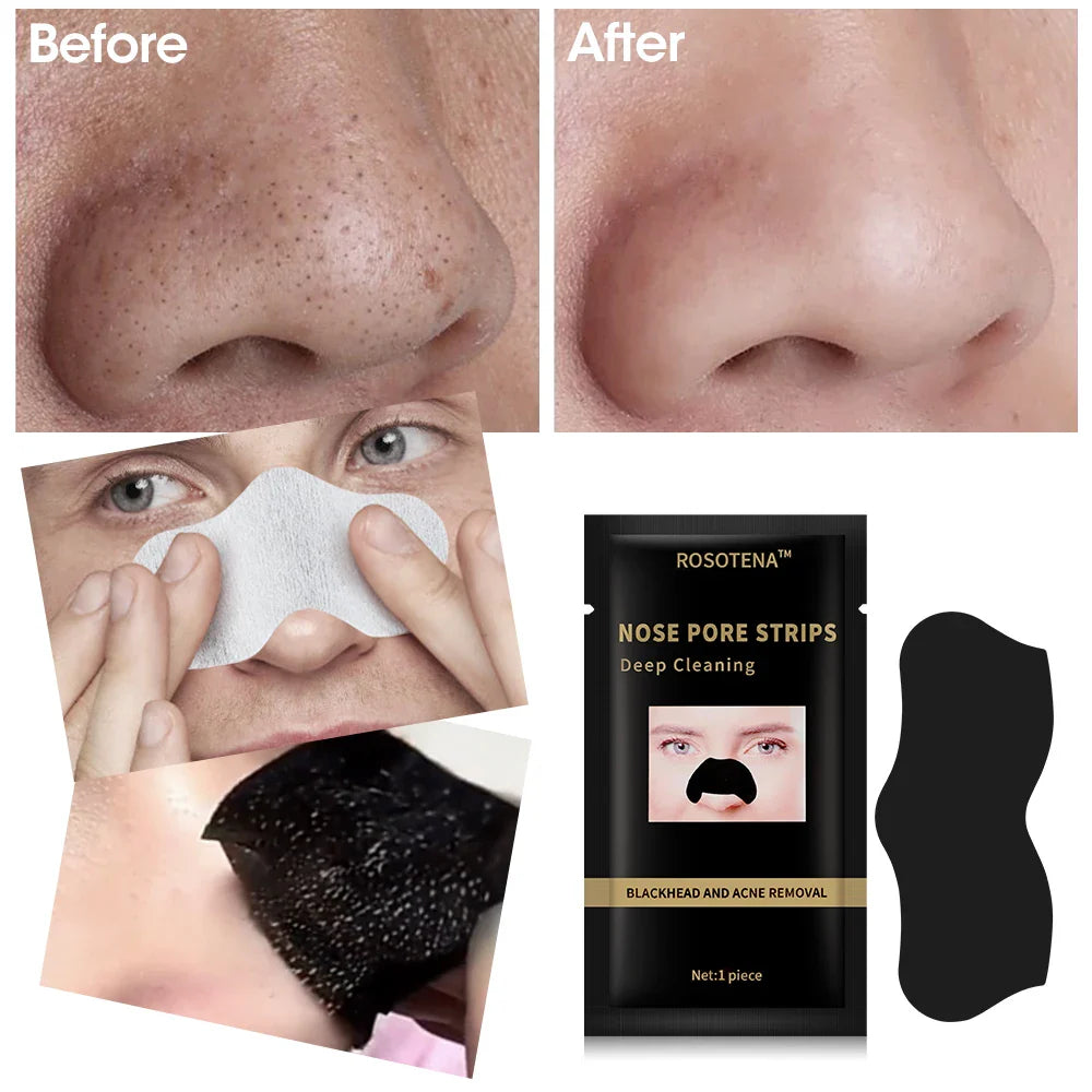 Povei Bamboo Charcoal Nose Patches for Blackhead Removal and Deep Pore Cleansing