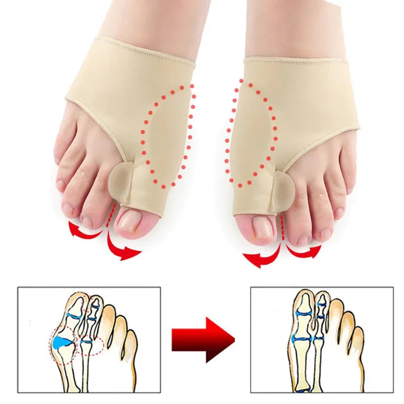 Povei Bunion Corrector Toe Separator Orthotics for Hallux Valgus - Straightener & Adjuster