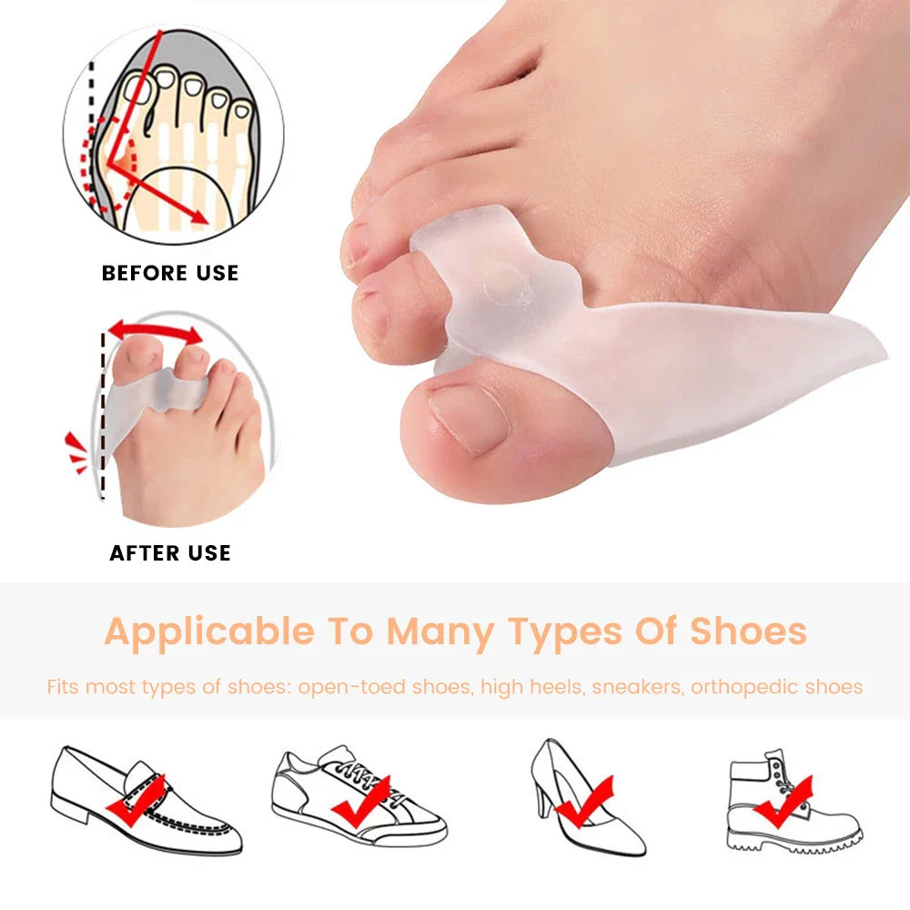 Povei Silicone Toe Separators: Bunion Corrector & Valgus Adjuster for Perfect Toe Alignment