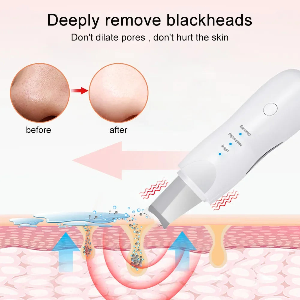 Povei Skin Scrubber Blackhead Remover and Pore Cleaner Machine