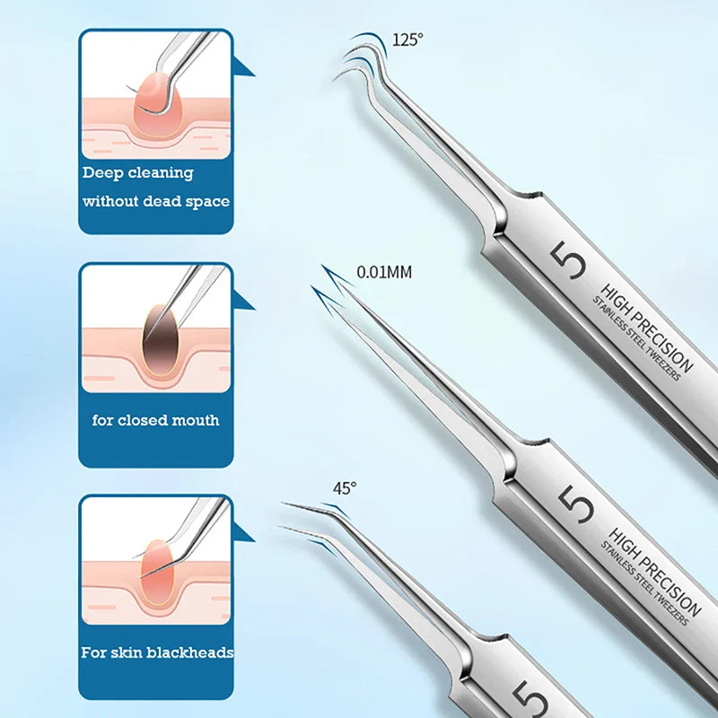 Povei Blackhead Pimples Extractor Acne Remover Tool for Face Skin Health