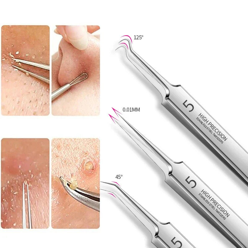 Povei Blackhead Pimples Extractor Acne Remover Tool for Face Skin Health