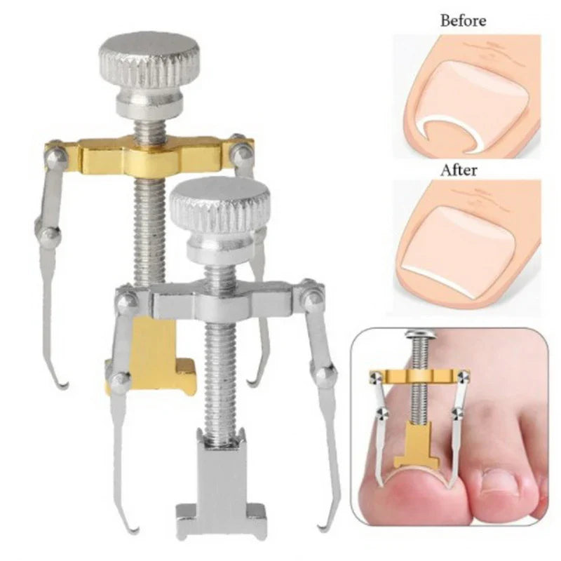 Povei Ingrown Toe Nail Corrector Tool: Orthotic Pedicure Fixer for Foot Nail Care