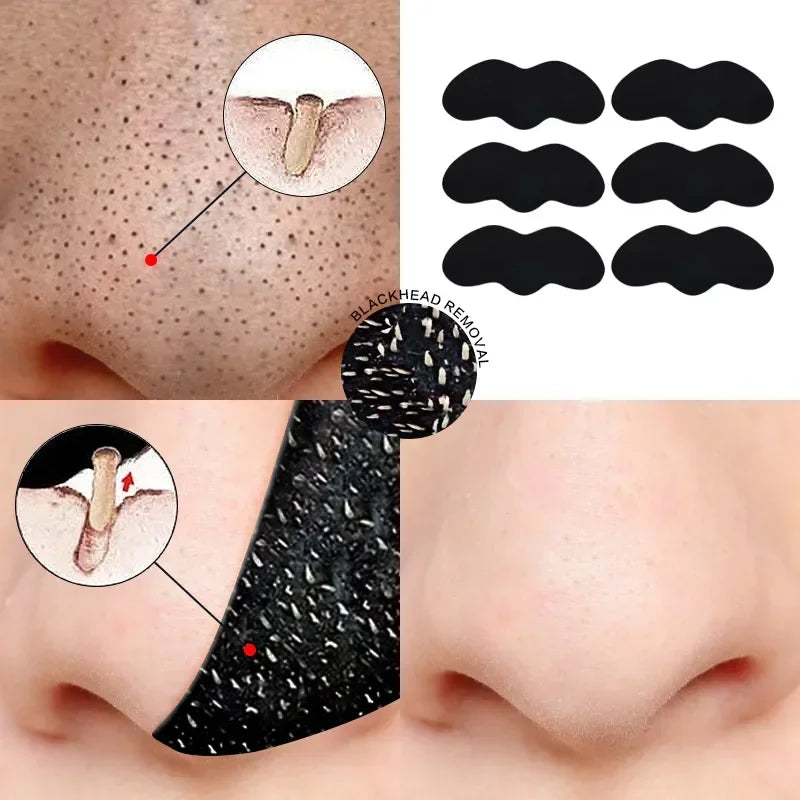 Povei Blackhead Remover Mask Pore Shrink Acne Treatment Deep Cleansing Skin Care