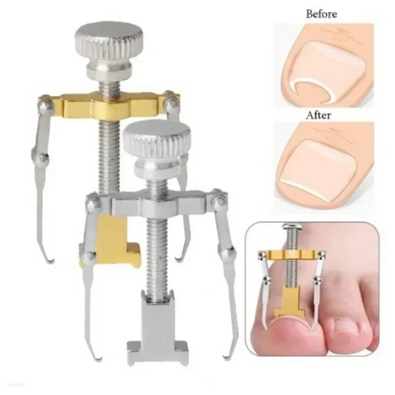 Povei Ingrown Toe Nail Corrector Tool - Foot Care Pedicure Fixer for Healthy Nails