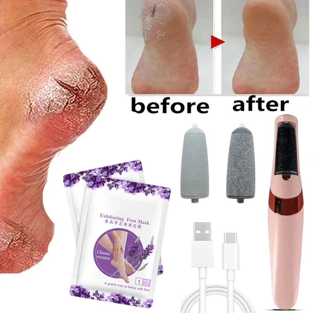 Povei Foot Spa Set: Electric Pedicure Machine, Exfoliating Mask, Callus Remover for Soft Heels