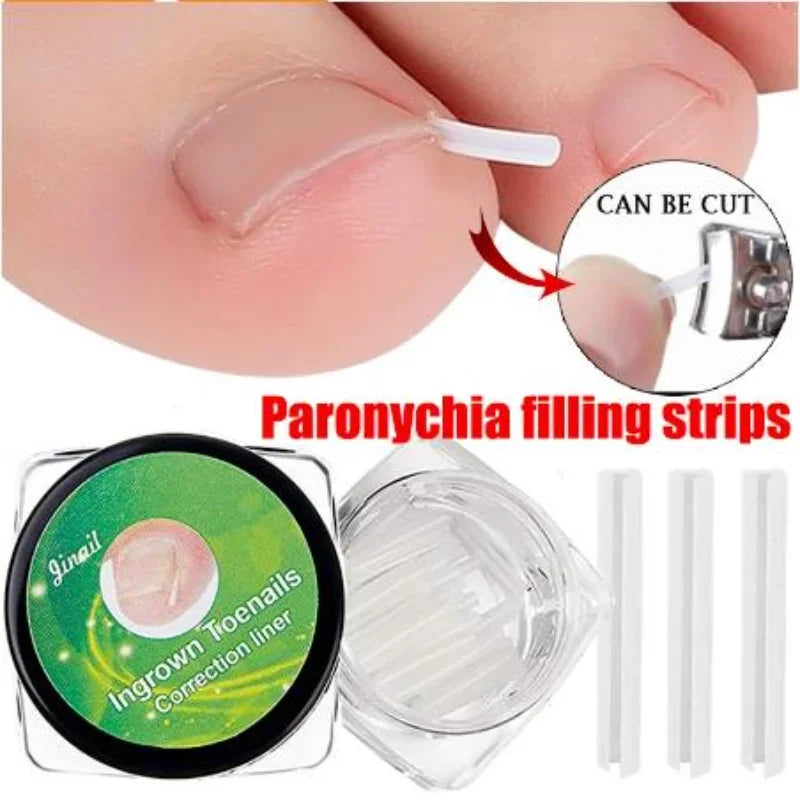 Povei Ingrown Toenail Correction Kit For Straightening Toe Nails