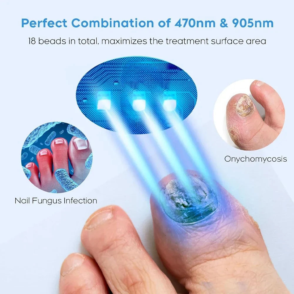 Povei Fungal Nail Laser Device: Fast Onychomycosis Repair for Toenail & Fingernail Fungus