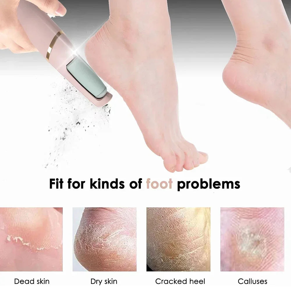 Povei Electric Foot Callus Remover Dead Skin Trimmer for Smooth Feet