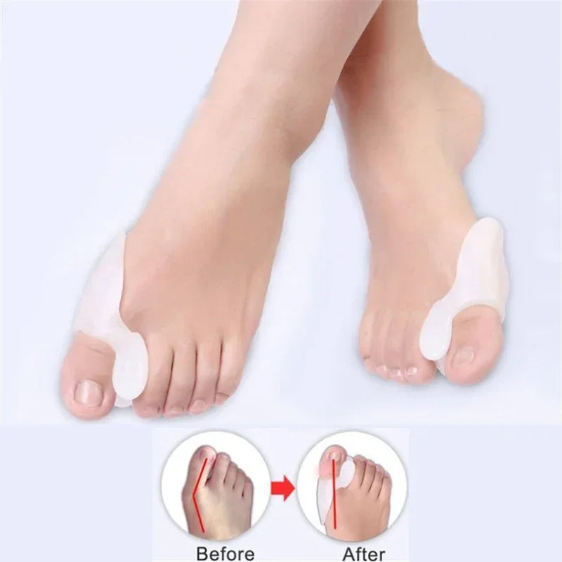 Bunion Corrector Set by Povei: Gel Pad, Stretch Nylon, Hallux Valgus Protector, Toe Separator