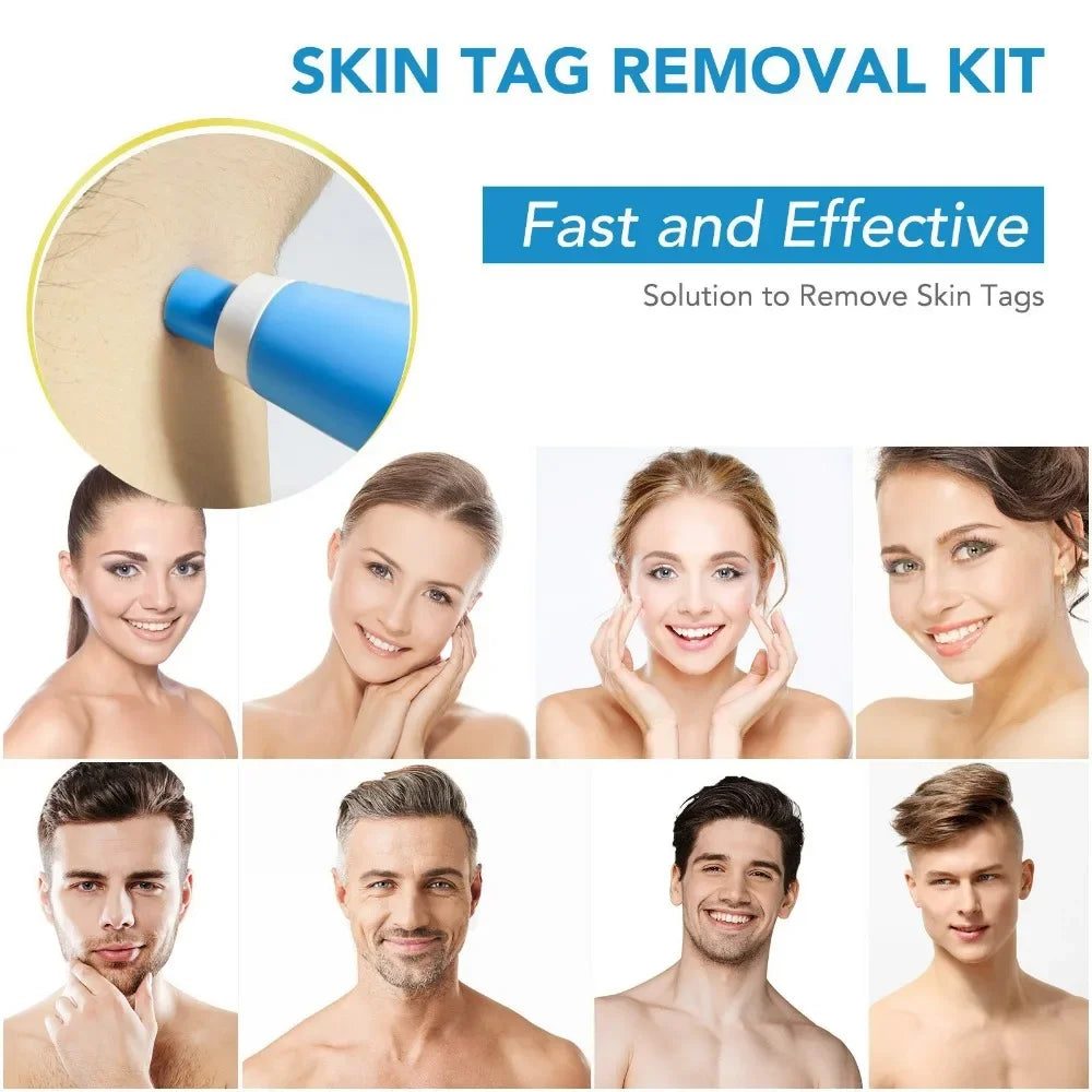 Povei Auto Skin Tag Mole Wart Removal Kit for Face & Body Skin Care