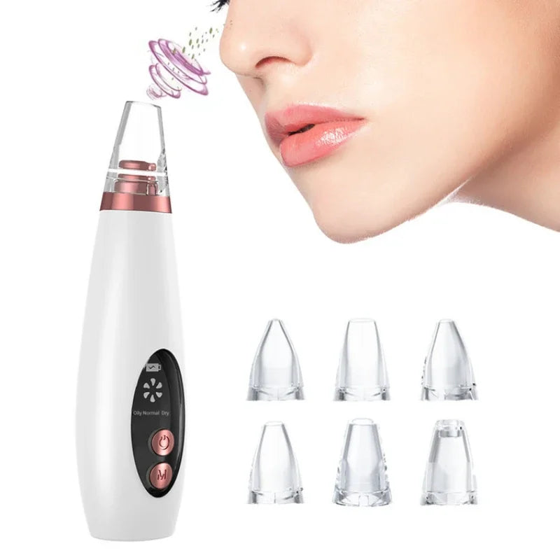 Povei Blackhead Remover Vacuum Pore Cleaner for Clear Skin