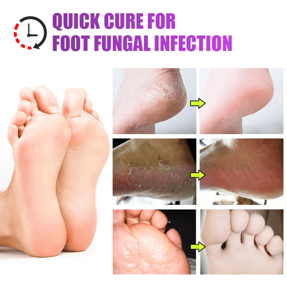 Povei Foot Care Ointment: Fungal Treatment & Odor Removal