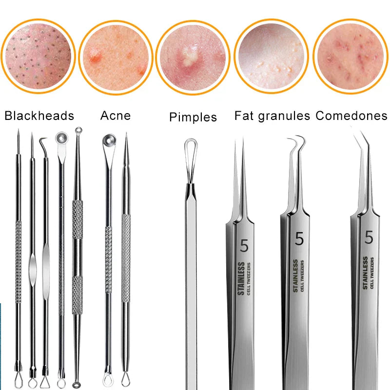 Povei Acne Blackhead Removal Needles Set of 4 - Deep Cleansing Tool for Face Skin Care