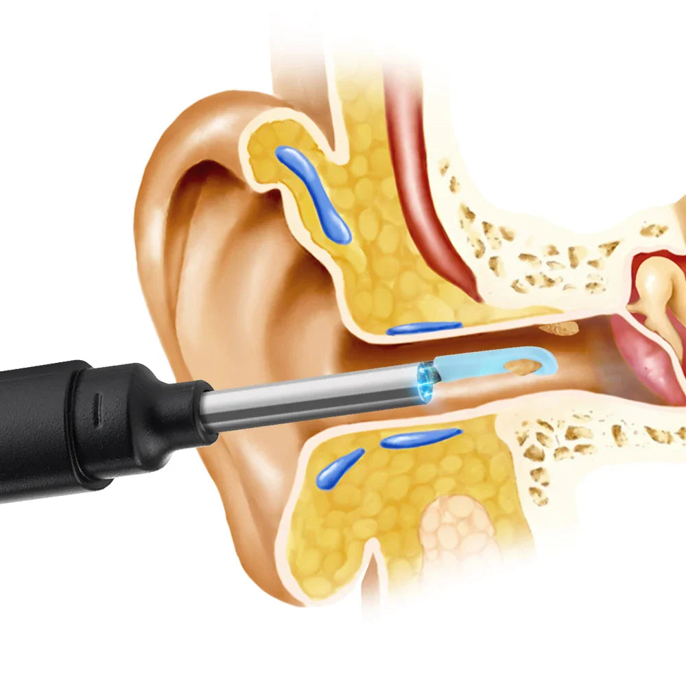 Povei 3.0MP Wireless Otoscope with 3.9mm Camera for Ear Wax Removal