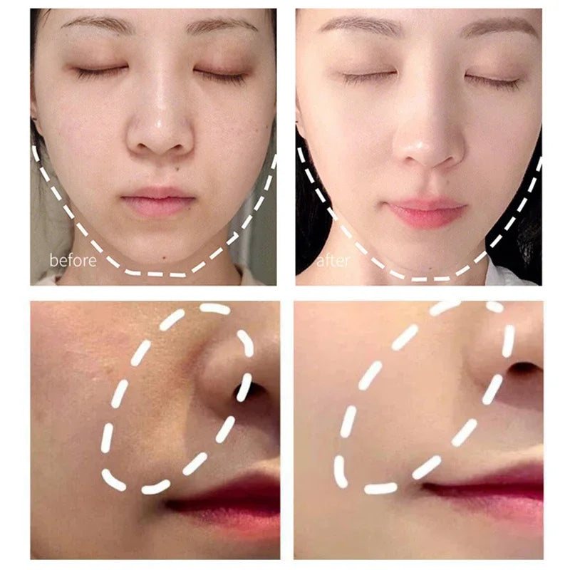 Povei Electric Facial Device for Face Lifting, Wrinkle Reduction, and Skin Rejuvenation