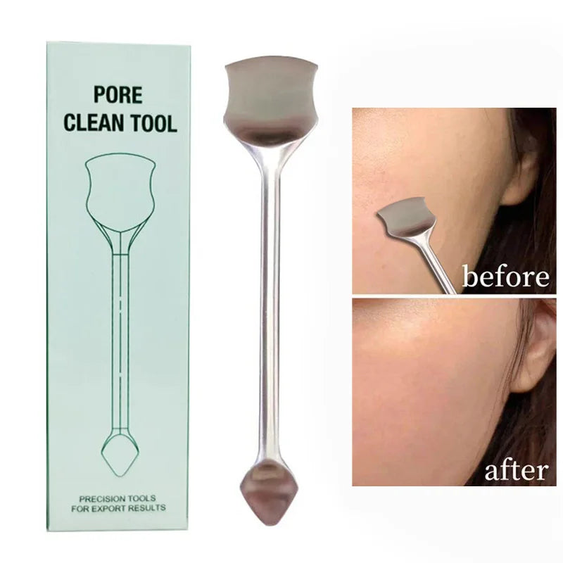 Povei Acne Blackhead Remover Extractor Tool - Skin Care Stainless Steel Cleaner