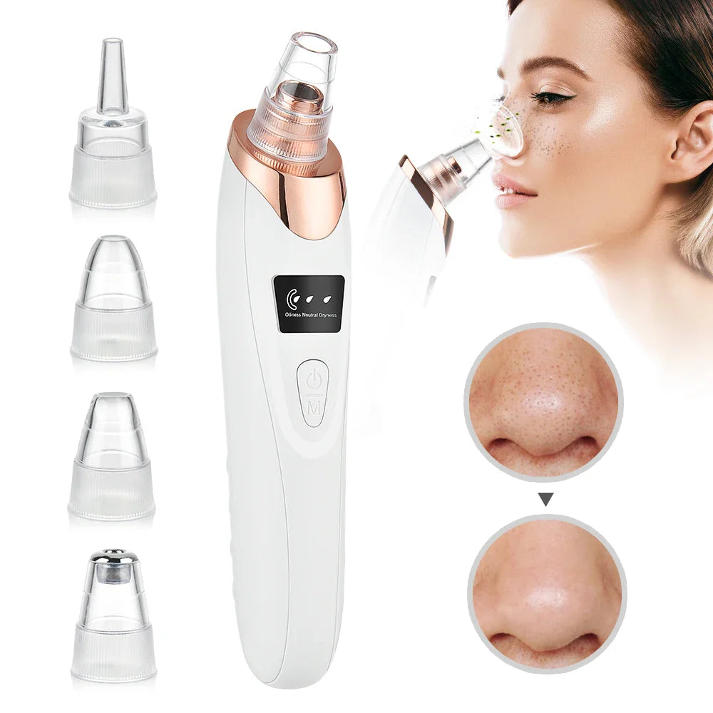 Povei Deep Cleansing Blackhead Remover Vacuum for Acne, Black Spots & Pore Cleaning