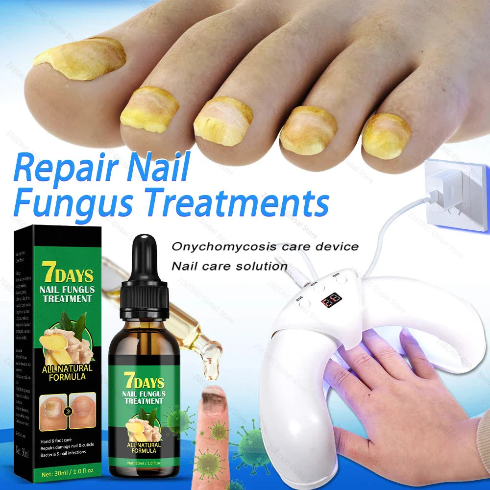 Povei Fungal Nail Laser Fast Repair Essence Oil Ingrown Cure Foot Care