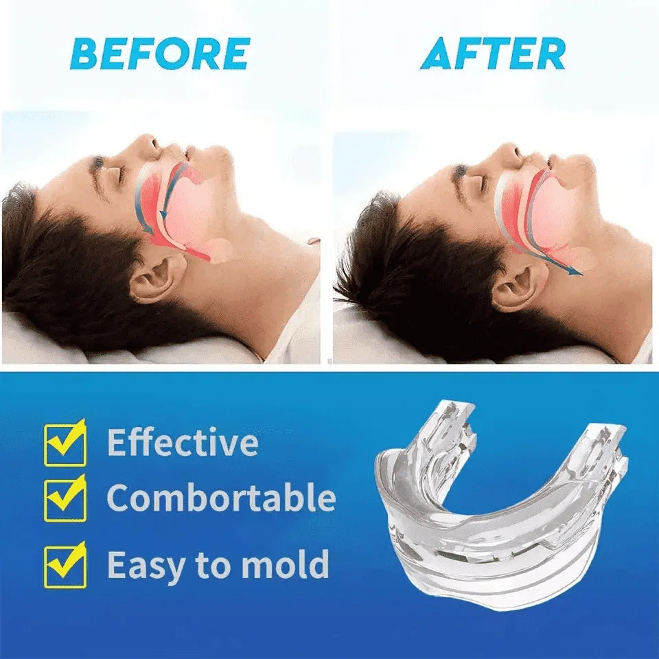 Povei Snore Guard Mouthpiece for Better Sleep Quality