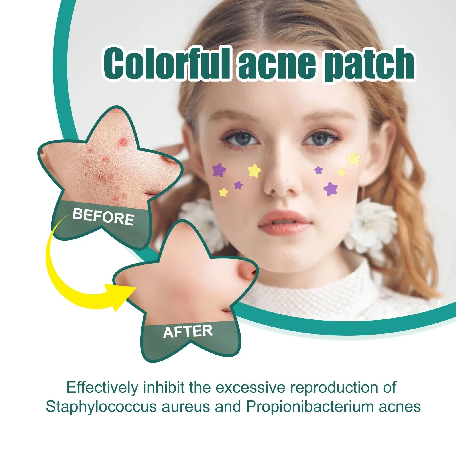 Povei Color Star Hydrocolloid Acne Patches - Acne Concealer Spot Bandages