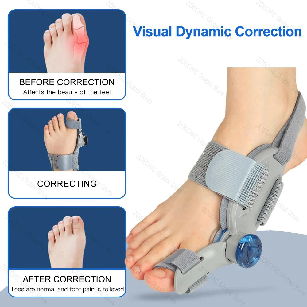 Povei Bunion Corrector & Big Toe Straightener - Adjustable Hallux Valgus Corrector