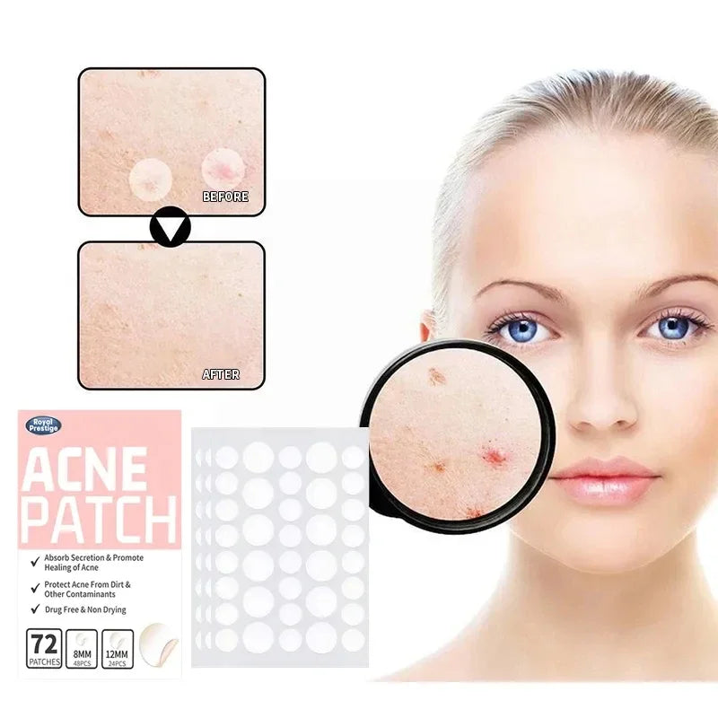 Povei Acne Patches: Invisible Hydrocolloid Stickers for Pimple Removal & Repair